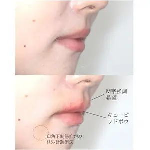 before image