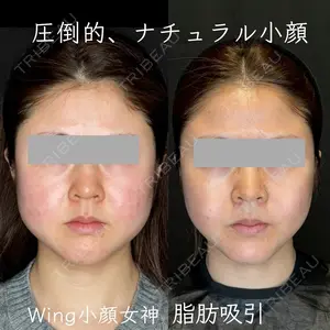 30 days after image