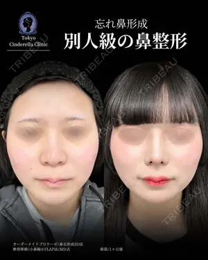 30 days after image