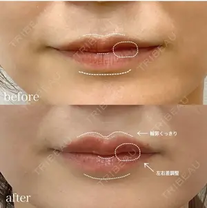 0 days after image