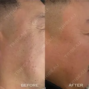 30 days after image
