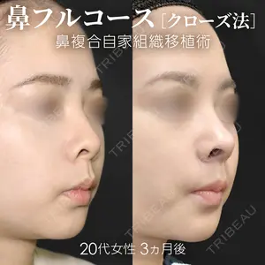 90 days after image