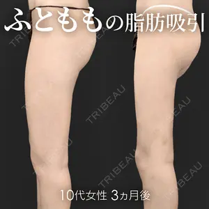 90 days after image