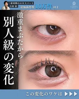 90 days after image