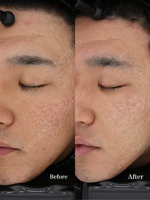 30 days after image