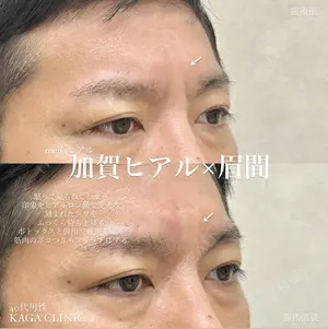 before image