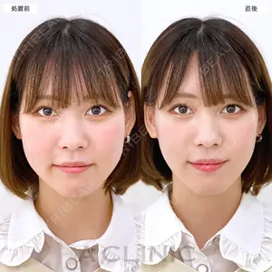 before image