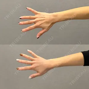 before image