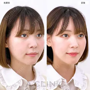 before image