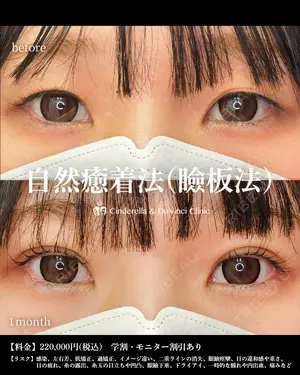 30 days after image