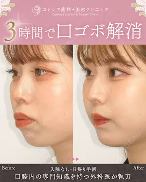 180 days after image