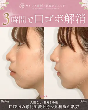 before image