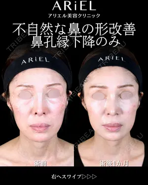 30 days after image