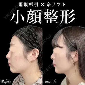 90 days after image