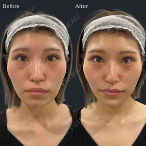 before image