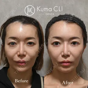 180 days after image