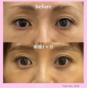 before image
