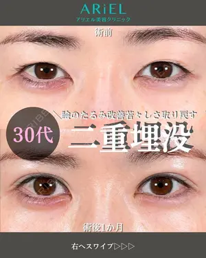 30 days after image