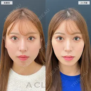 60 days after image