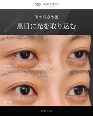 90 days after image