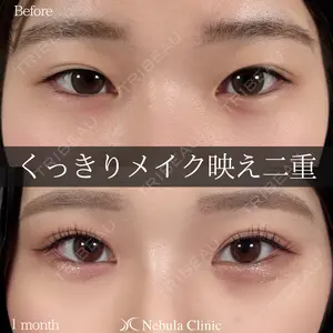 30 days after image