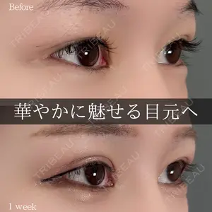 7 days after image