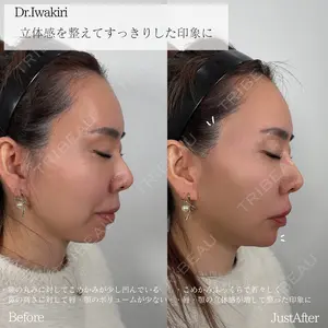 0 days after image