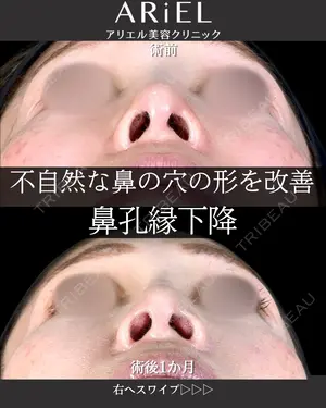 30 days after image