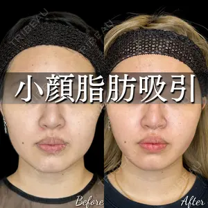 30 days after image