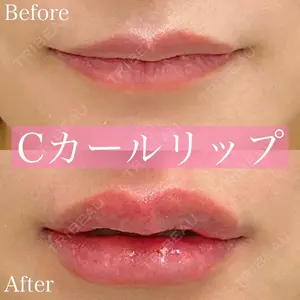 1 days after image
