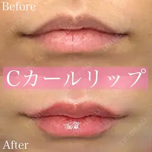 before image