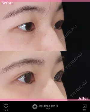before image