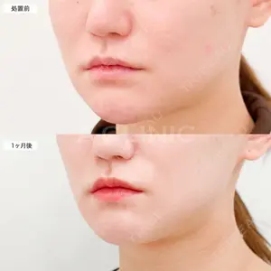 30 days after image