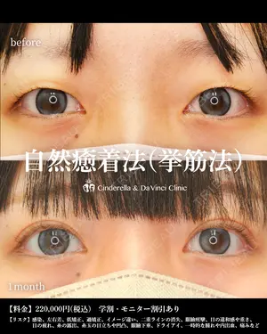 30 days after image