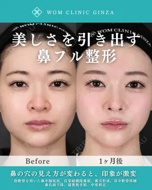 30 days after image
