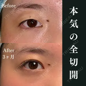 before image