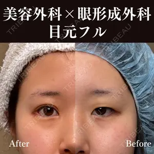 30 days after image
