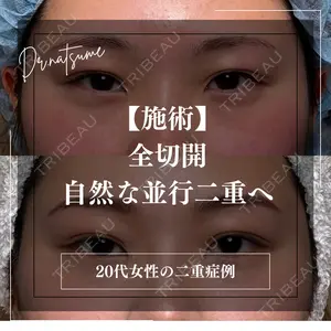 30 days after image