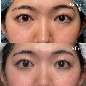 30 days after image