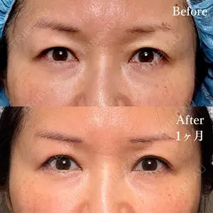 30 days after image