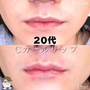 before image