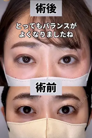 before image