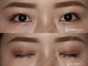30 days after image