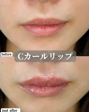 before image