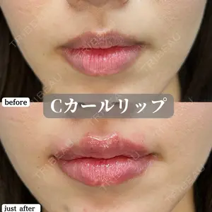 before image