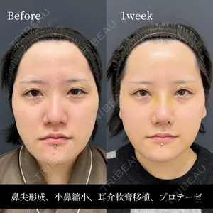 before image