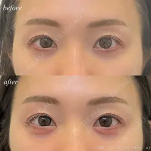 before image