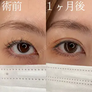 30 days after image