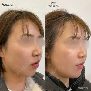 before image