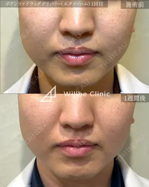 before image